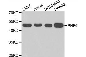 Western blot analysis of extracts of various cell lines, using PHF6 antibody (ABIN4904747) at 1:1000 dilution. (PHF6 anticorps)