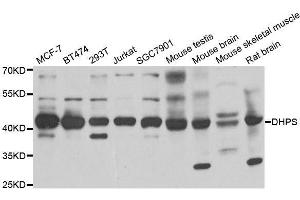 Western blot analysis of extracts of various cell lines, using DHPS antibody. (DHPS anticorps  (AA 1-369))