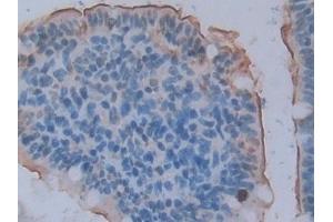 Detection of ACE2 in Rat Small intestine Tissue using Polyclonal Antibody to Angiotensin I Converting Enzyme 2 (ACE2)