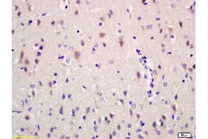 Formalin-fixed and paraffin embedded rat brain labeled with Anti-Ribonuclease Inhibitor Polyclonal Antibody, Unconjugated (ABIN872914) at 1:200 followed by conjugation to the secondary antibody and DAB staining.