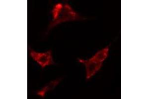 ABIN6274187 staining HepG2 cells by IF/ICC. (ADRA2C anticorps  (Internal Region))