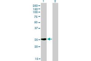 Western Blot analysis of IGSF6 expression in transfected 293T cell line by IGSF6 monoclonal antibody (M01), clone 2A12. (IGSF6 anticorps  (AA 29-241))