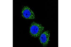 Confocal immunofluorescent analysis of MEN1 Antibody  (ABIN391614 and ABIN2841535) with Hela cell followed by Alexa Fluor 488-conjugated goat anti-rabbit lgG (green). (Menin anticorps  (AA 584-615))