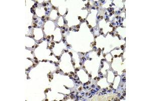 Immunohistochemistry of paraffin-embedded mouse lung using CBX5 antibody.