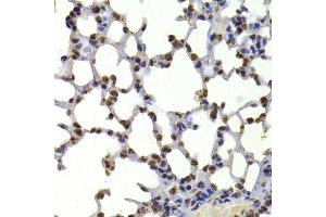 Immunohistochemistry of paraffin-embedded mouse lung using CBX5 antibody. (CBX5 anticorps  (AA 1-100))