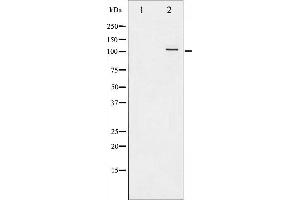 Western blot analysis of NF kappaB p105/p50 phosphorylation expression in TNF-α treated HeLa whole cell lysates,The lane on the left is treated with the antigen-specific peptide.