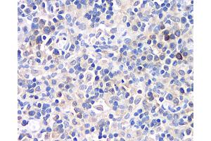 Immunohistochemistry analysis of paraffin-embedded rat lymph node using CD284 Polyclonal Antibody at dilution of 1:500. (TLR4 anticorps)