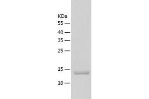 G Antigen 12F (GAGE12F) (AA 1-117) protein (His-IF2DI Tag)