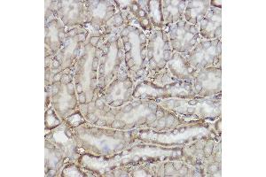 Immunohistochemistry of paraffin-embedded mouse kidney using TRPC6 Rabbit pAb (ABIN6133946, ABIN6149580, ABIN6149581 and ABIN6224178) at dilution of 1:150 (40x lens). (TRPC6 anticorps  (AA 500-600))