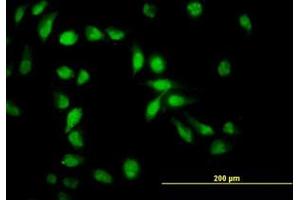 Image no. 4 for anti-Apoptosis Inhibitor 5 (API5) (AA 400-504) antibody (ABIN466131) (Apoptosis Inhibitor 5 anticorps  (AA 400-504))