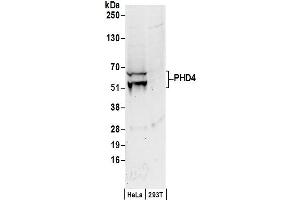 anti-Prolyl 4-Hydroxylase, Transmembrane (Endoplasmic Reticulum) (P4HTM) (C-Term) antibody