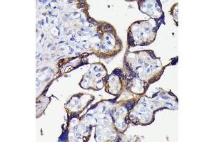 Immunohistochemistry of paraffin-embedded human placenta using  antibody (ABIN7265710) at dilution of 1:100 (40x lens). (ATG5 anticorps)