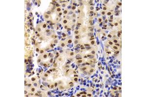 Immunohistochemistry of paraffin-embedded Human gastric using XRCC5 antibody at dilution of 1:100 (40x lens). (XRCC5 anticorps)