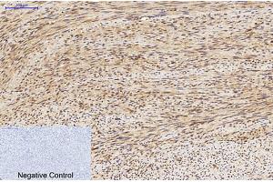 Immunohistochemical analysis of paraffin-embedded human uterus tissue. (MAP1LC3A anticorps)