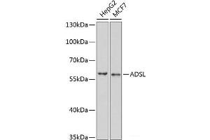 Western blot analysis of extracts of various cell lines using ADSL Polyclonal Antibody at dilution of 1:1000. (Adenylosuccinate Lyase anticorps)
