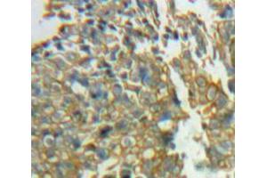 Used in DAB staining on fromalin fixed paraffin-embedded Ovary tissue (SIRPG anticorps  (AA 111-372))