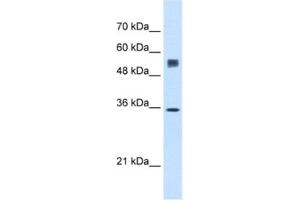 Western Blotting (WB) image for anti-Signal Sequence Receptor, alpha (SSR1) antibody (ABIN2462851) (SSR1 anticorps)