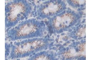 Detection of SDF4 in Rat Colon Tissue using Polyclonal Antibody to Stromal Cell Derived Factor 4 (SDF4)