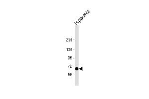 Anti-STT3A Antibody (Center) at 1:2000 dilution + human placenta lysate Lysates/proteins at 20 μg per lane. (STT3A anticorps  (AA 476-507))