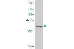Western Blot detection against Immunogen (37.