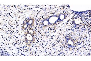 Detection of MMP7 in Rat Uterus Tissue using Polyclonal Antibody to Matrix Metalloproteinase 7 (MMP7)