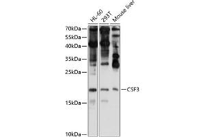 Western blot analysis of extracts of various cell lines, using CSF3 antibody (ABIN6127710, ABIN6139100, ABIN6139101 and ABIN6221772) at 1:1000 dilution. (G-CSF anticorps  (AA 30-207))