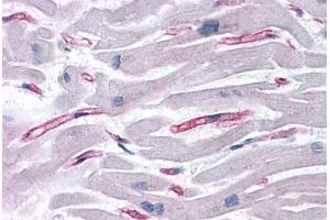 Human Heart: Formalin-Fixed, Paraffin-Embedded (FFPE) (SLAIN1 anticorps  (C-Term))