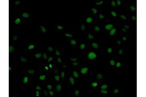 Immunofluorescence analysis of HeLa cell using PLCG2 antibody. (Phospholipase C gamma 2 anticorps  (AA 1-300))
