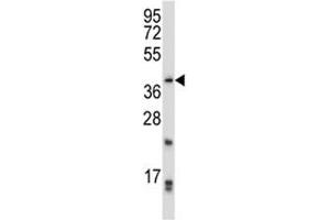 PITX2 antibody western blot analysis in CEM lysate.