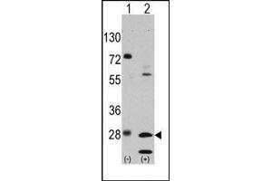 Image no. 1 for anti-Growth Factor Receptor-Bound Protein 2 (GRB2) (Tyr209) antibody (ABIN358793) (GRB2 anticorps  (Tyr209))