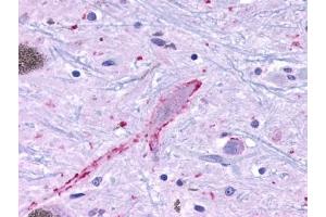 Immunohistochemical staining of Brain (Neurons and glia) using anti- MRGPRF antibody ABIN122237 (Mrgprf anticorps  (Cytoplasmic Domain))
