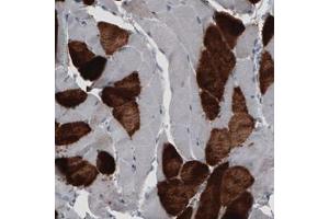 Immunohistochemical staining (Formalin-fixed paraffin-embedded sections) of human skeletal muscle with MYH6 monoclonal antibody, clone CL2162  shows strong cytoplasmic immunoreactivity in a subset of striated muscle fibers.