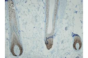 Immunohistochemistry (IHC) image for anti-T-Complex 1 (TCP1) (AA 360-383), (Internal Region) antibody (ABIN7598822) (TCP1 alpha/CCTA anticorps  (Internal Region))