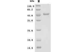 (Tris-Glycine gel) Discontinuous SDS-PAGE (reduced) with 5 % enrichment gel and 15 % separation gel.
