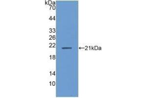 Detection of Recombinant ANP32A, Human using Polyclonal Antibody to Acidic Nuclear Phosphoprotein 32 Family, Member A (ANP32A) (PHAP1 anticorps  (AA 2-175))