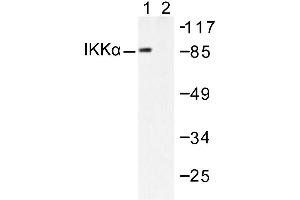 Image no. 1 for anti-conserved Helix-Loop-Helix Ubiquitous Kinase (CHUK) antibody (ABIN265477) (IKK alpha anticorps)