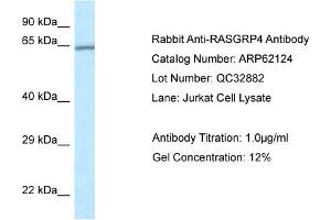 Western Blotting (WB) image for anti-RAS Guanyl Releasing Protein 4 (RASGRP4) (N-Term) antibody (ABIN2789029)
