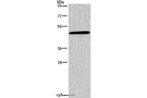 Western blot analysis of 293T cell, using GCGR Polyclonal Antibody at dilution of 1:200 (Glucagon Receptor anticorps)