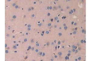 Detection of LAMb2 in Mouse Cerebrum Tissue using Polyclonal Antibody to Laminin Beta 2 (LAMb2)