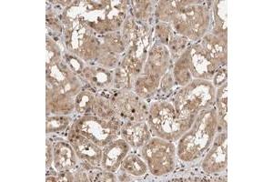 Immunohistochemical staining of human kidney with LEMD3 polyclonal antibody  shows nuclear positivity often accentuated to the membrane in renal tubules.