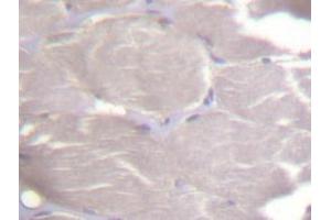 Immunohistochemistry (IHC) analyzes of IKKα/β antibody in paraffin-embedded human skeletal muscle tissue. (IKK alpha anticorps)