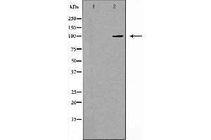 Western blot analysis of extracts from Jurkat cells using CDH17 antibody.