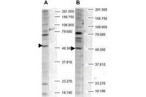 Western blot analysis is shown using SH3BP2 (phospho S427) polyclonal antibody  to detect endogenous protein present in unstimulated human whole cell lysates. (SH3BP2 anticorps  (pSer427))