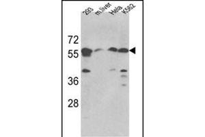Western blot analysis of hSPTLC1-S41 (ABIN389108 and ABIN2839298) in 293, Hela, K562 cell line and mouse liver tissue lysates (35 μg/lane). (SPTLC1 anticorps  (N-Term))