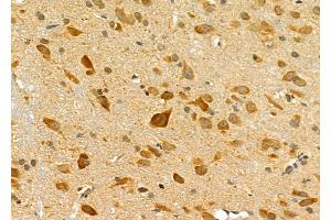 ABIN6257607 and ABIN6275769 at 1/100 staining Rat brain tissue by IHC-P.