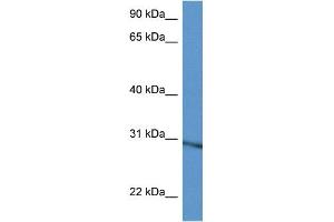 WB Suggested Anti-Rpl5 Antibody Titration: 1. (RPL5 anticorps  (C-Term))