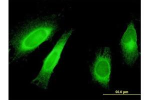 Immunofluorescence of monoclonal antibody to STAU1 on HeLa cell. (STAU1/Staufen anticorps  (AA 401-496))