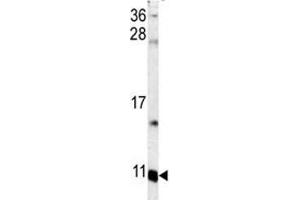 Western blot analysis of S100A6 antibody and mouse lung tissue lysate. (S100A6 anticorps  (AA 37-67))