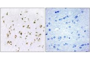 Immunohistochemistry analysis of paraffin-embedded human brain tissue, using HMG17 Antibody. (HMGN2 anticorps  (AA 1-50))