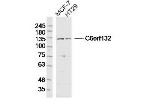 Lane 1: MCF-7 lysates Lane 2: HT29 lysates probed with C6orf132 Polyclonal Antibody, Unconjugated  at 1:300 dilution and 4˚C overnight incubation. (C6ORF132 anticorps  (AA 1001-1188))